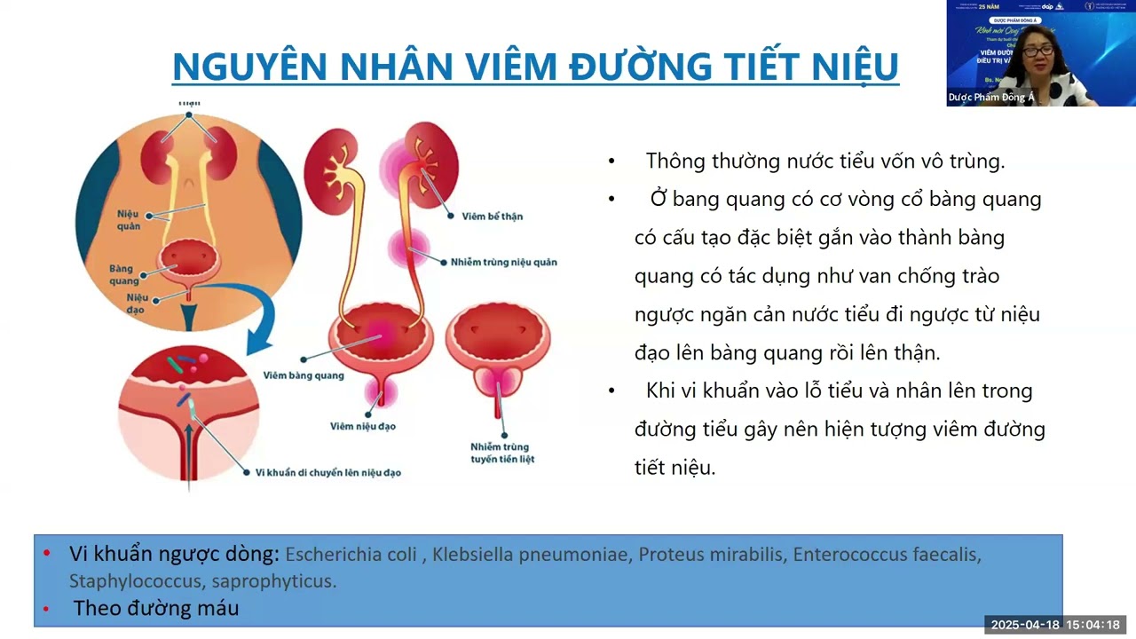 BỆNH VIÊM ĐƯỜNG TIẾT NIỆU