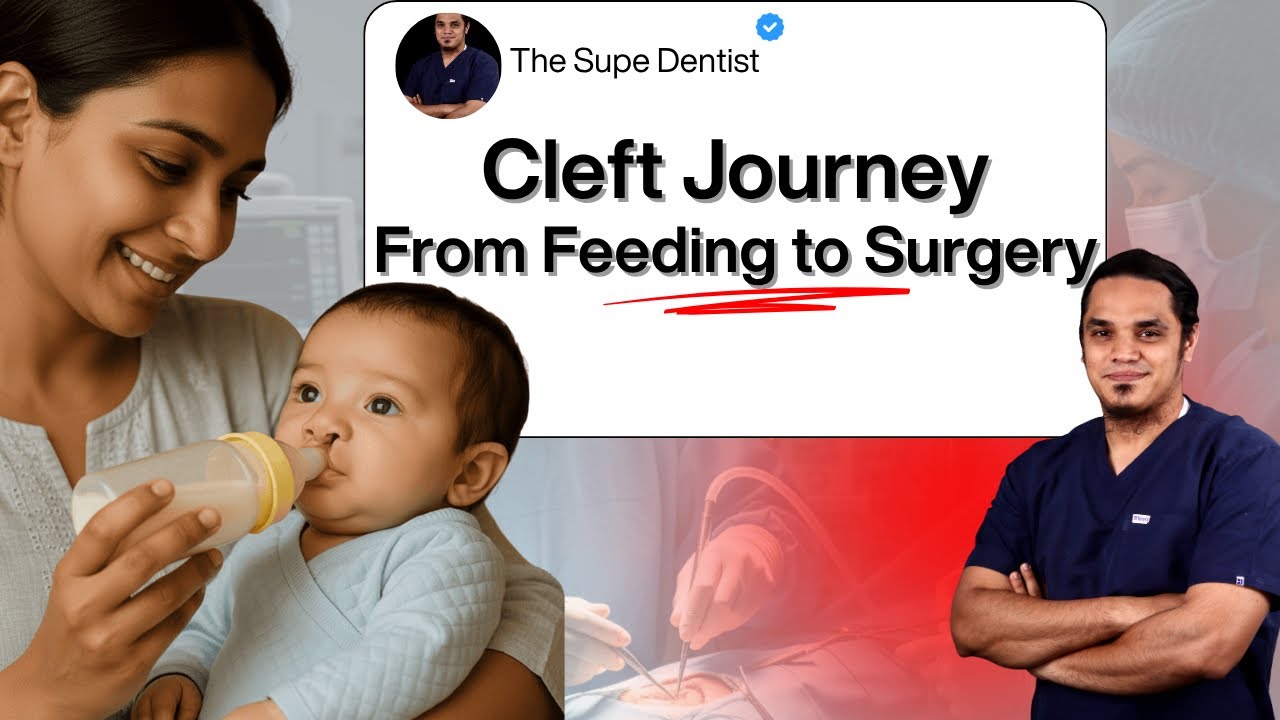 Cleft Care: The First 2 Years | What Parents Should Know (Part 2 of My Cleft Story)