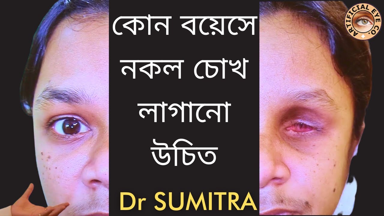 কোন বয়েসে নকল চোখ লাগানো উচিত | Dr Sumitra