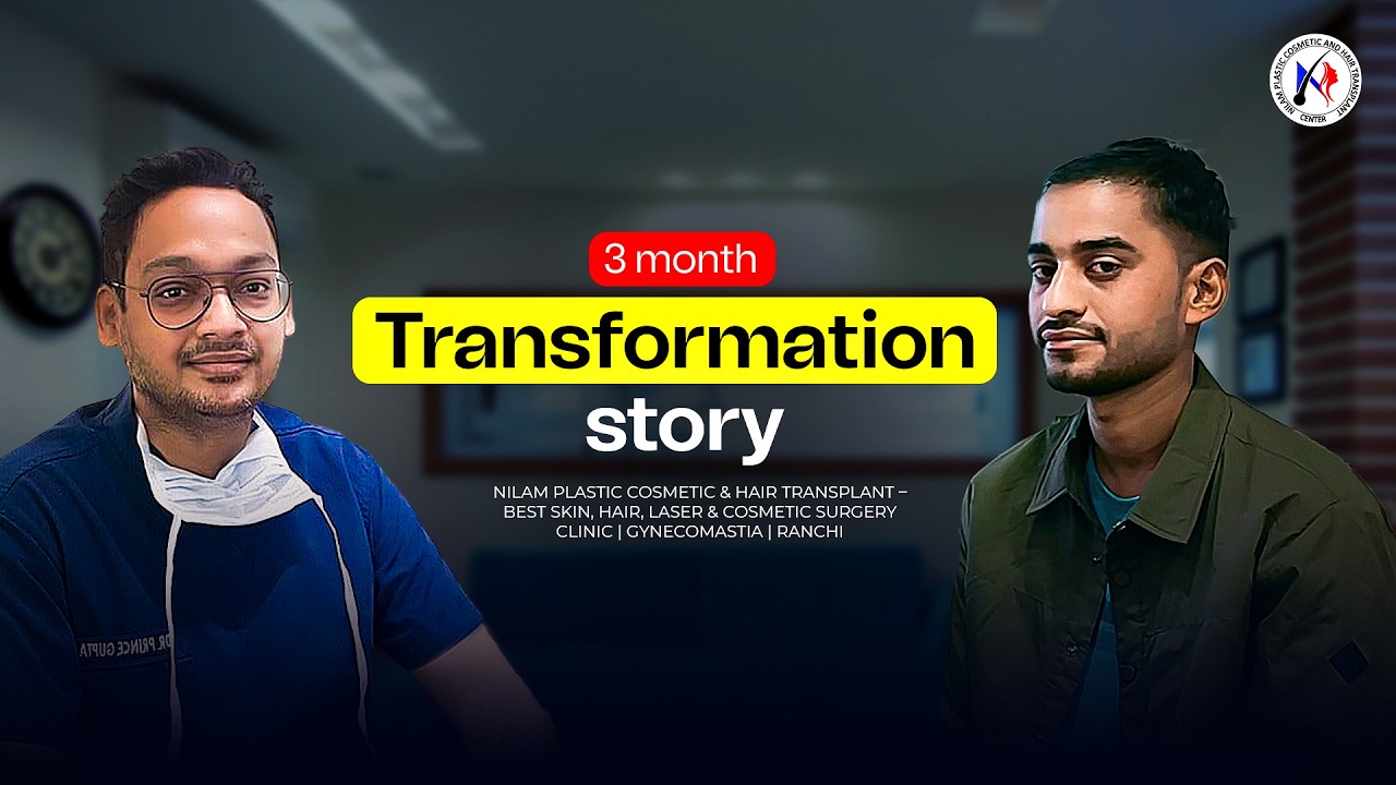 3 Months After Hair Transplant 😲 | Real Patient Experience with Dr. Prince | Ranchi