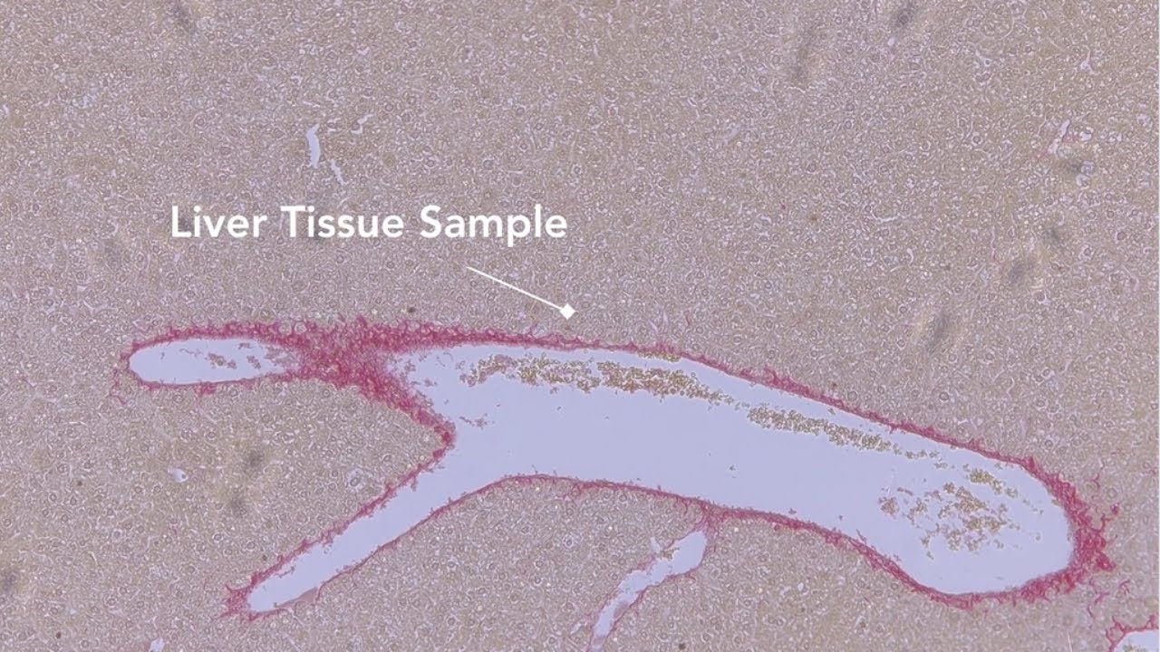 In-vitro modeling reveals how Leishmania affects liver tissues