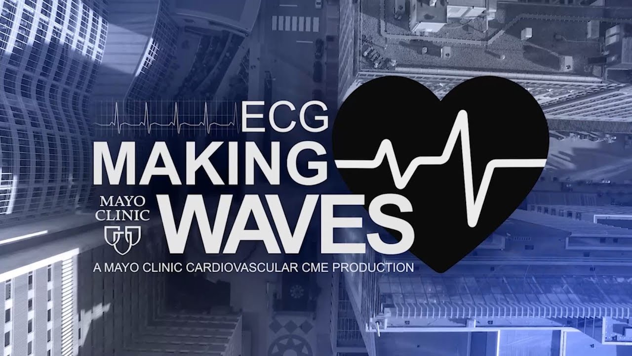 Evolution of Computerized ECG Interpretation