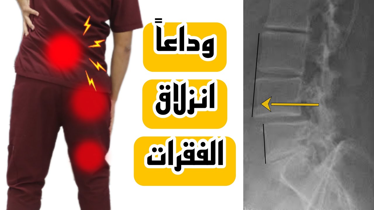 التمرين الساحر لعلاج تزحزح الفقرات والم الظهر |علاج انزلاق الفقرات بدون جراحه|تقوية عضلات حزام الوسط