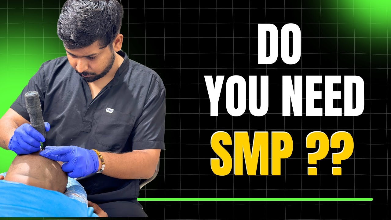 Scalp micropigmentation in India @drpavansurve Benefits of SMP #scalpmicropigmentation #scalpdots