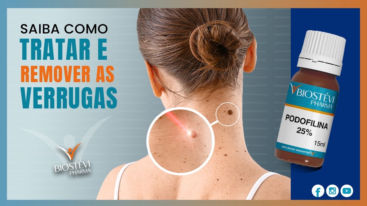 Podofilina: Tratamento de verrugas dermatol&oacute;gicas