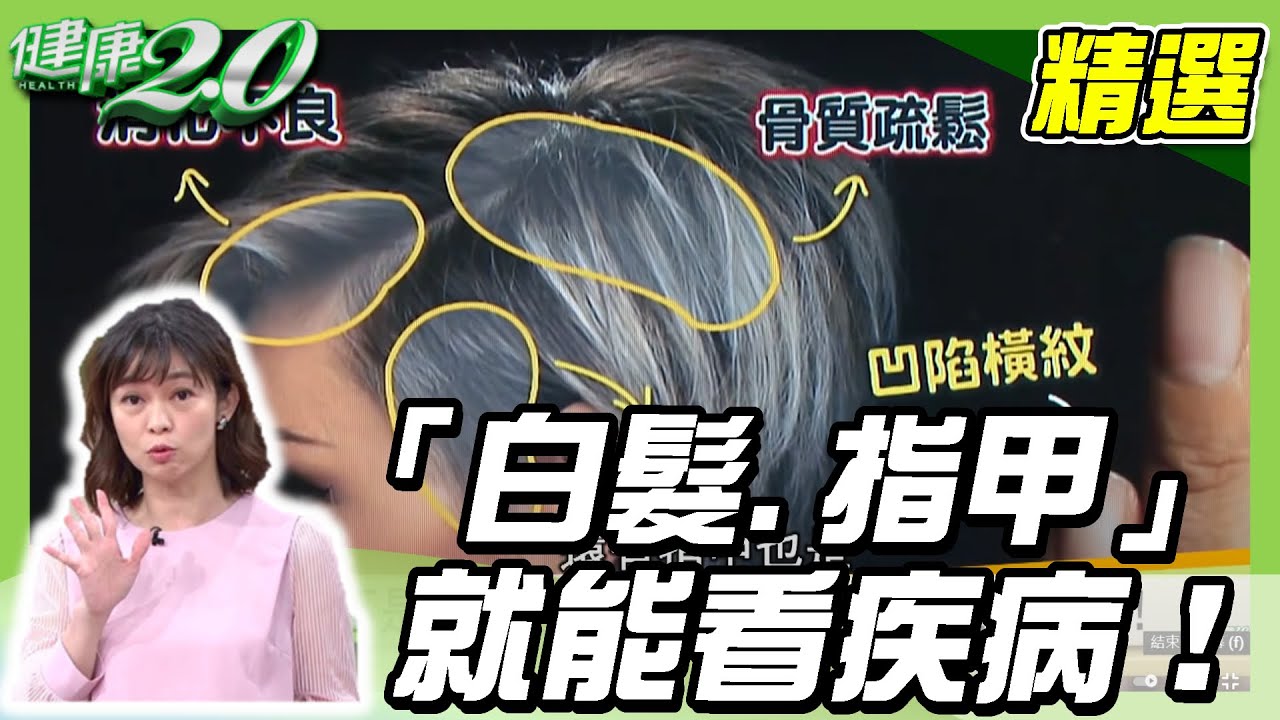 身體好不好「白髮、指甲」就能看疾病！改善白髮這樣做【@tvbshealth20 精選】