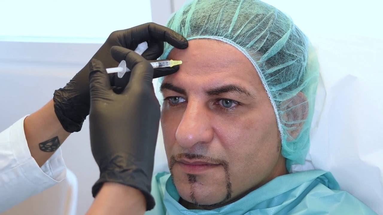 Dr. Natalie Keller – Volumenaufbau Stirn und Tränenringe + Botulinumtoxin Stirn und Zornesfalte