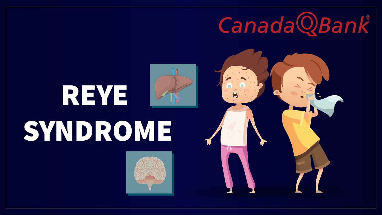 Reye Syndrome: Causes, Symptoms & Management | High-Yield Pediatrics | CanadaQBank