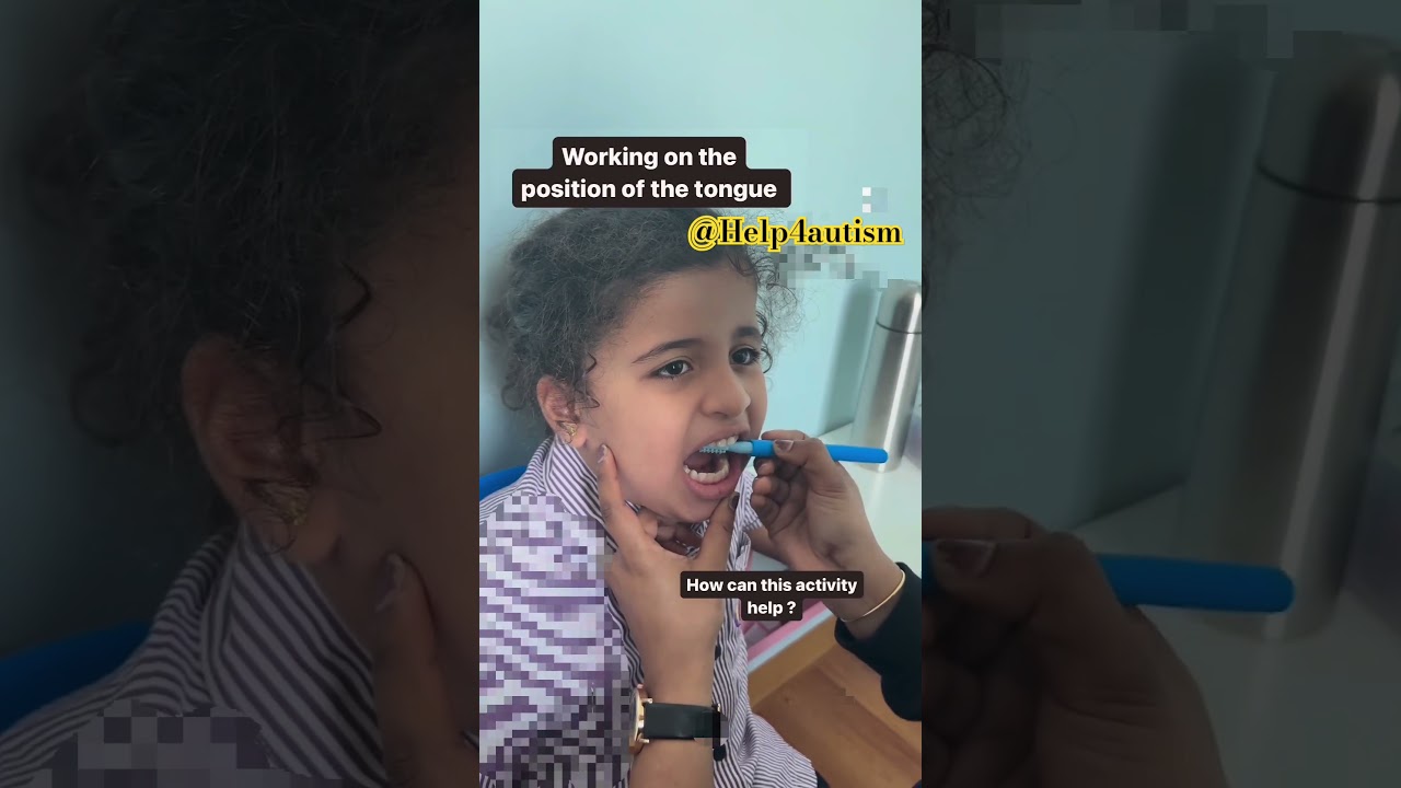 Speech Therapy/Oral Placement exercise