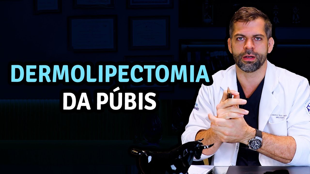 A Dermolipectomia da Púbis  | Dr. Marco Túlio Cavalcanti