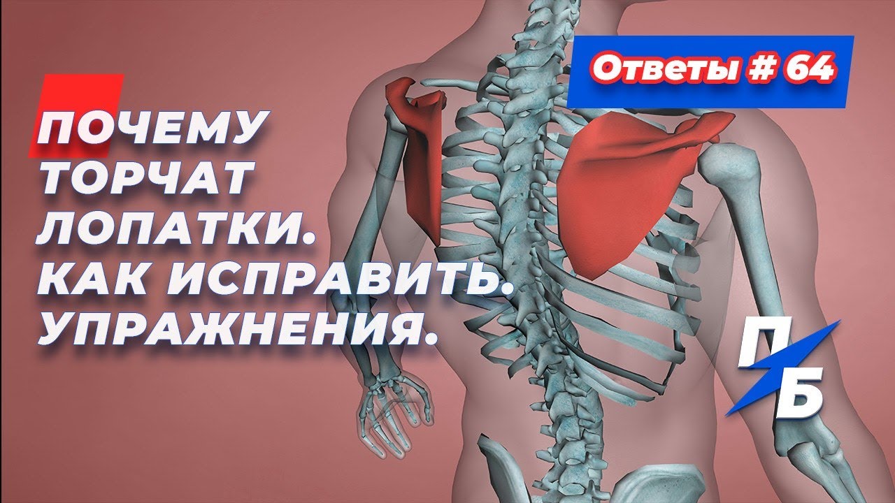 Почему торчат лопатки. Как исправить. Упражнения. Ответы 64