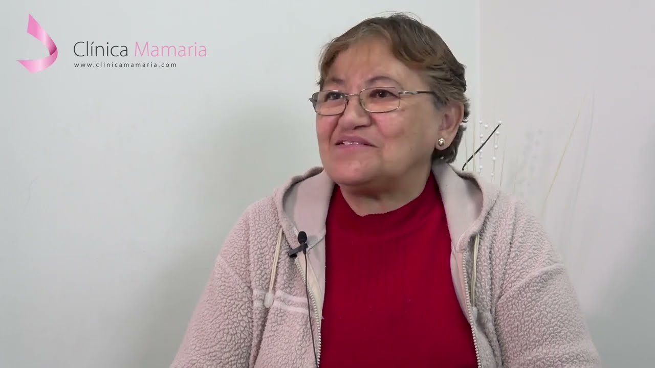 Paciente operada de tumor Phyllodes de mama izquierda - Dra. Mirian Pinto