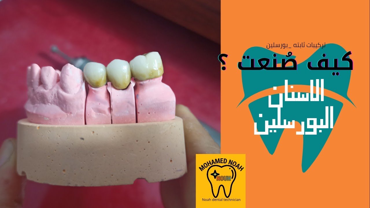 شاهدكيف صنعت الاسنان البورسلين (الجزء الاول) - How I Made Porcelain (Part 1)