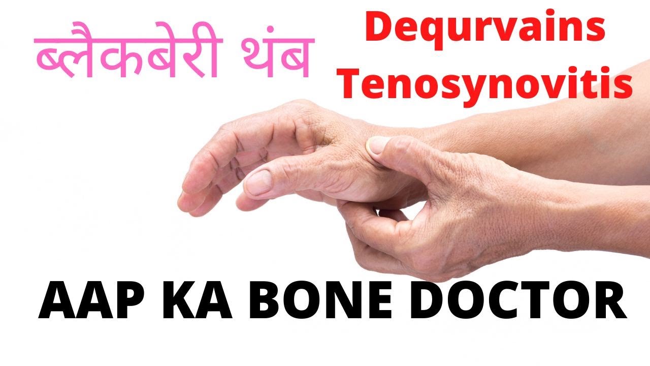 BLACKBERRY THUMB OR DEQURVAIN'S TENOSYNOVITIS. EPISODE 3