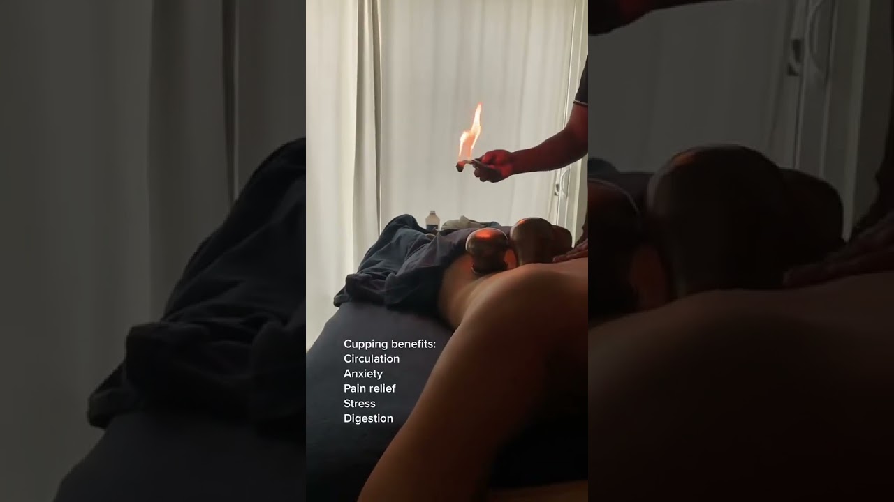 Traditional Healing That Actually Works? Try Cupping 🔥