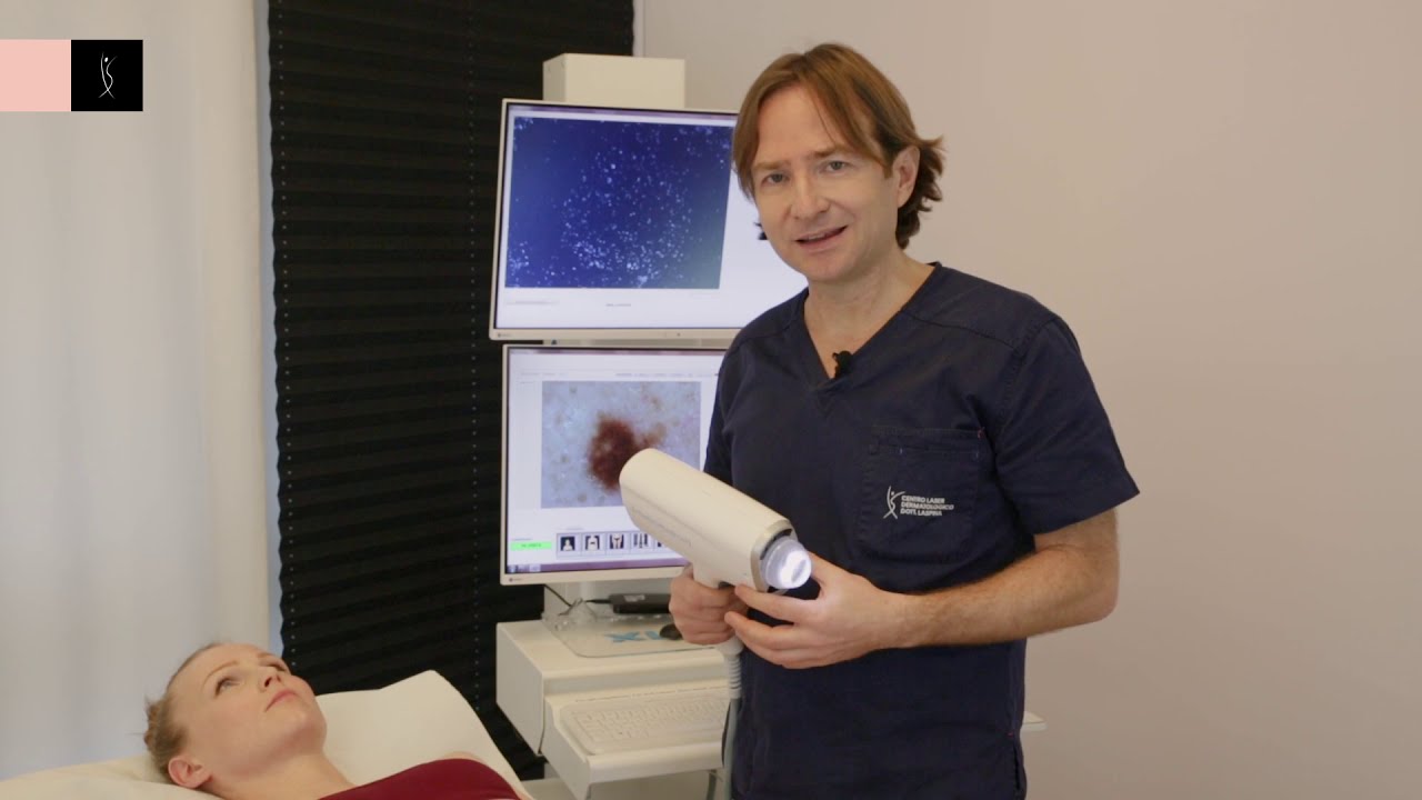 Videodermatoscopia