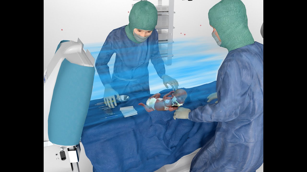 La chirurgie des bébés prématurés