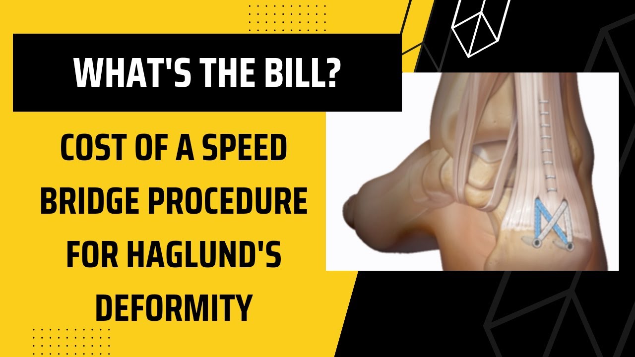 Speed Bridge procedure price for Haglund's Deformity