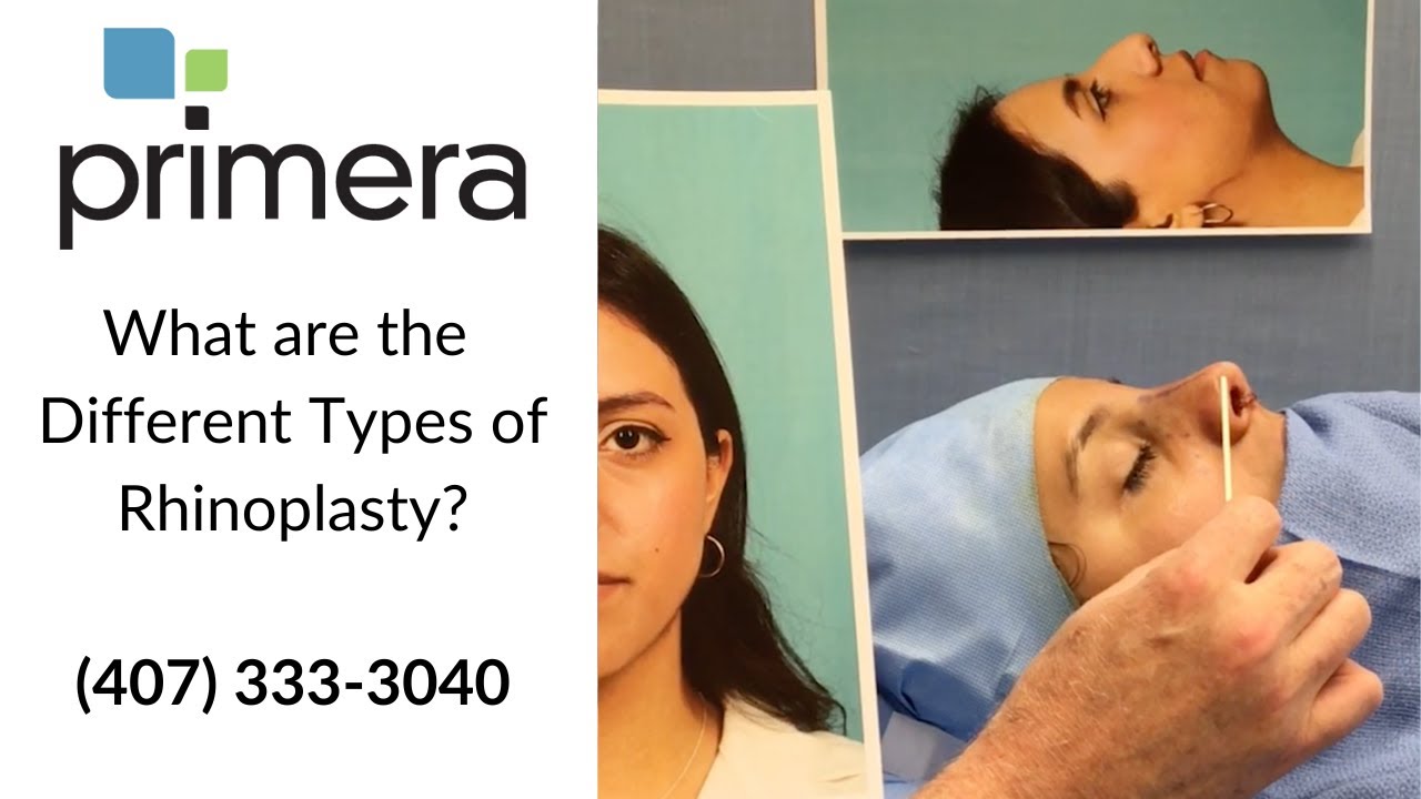 What are the Different Types of Rhinoplasty Surgery?