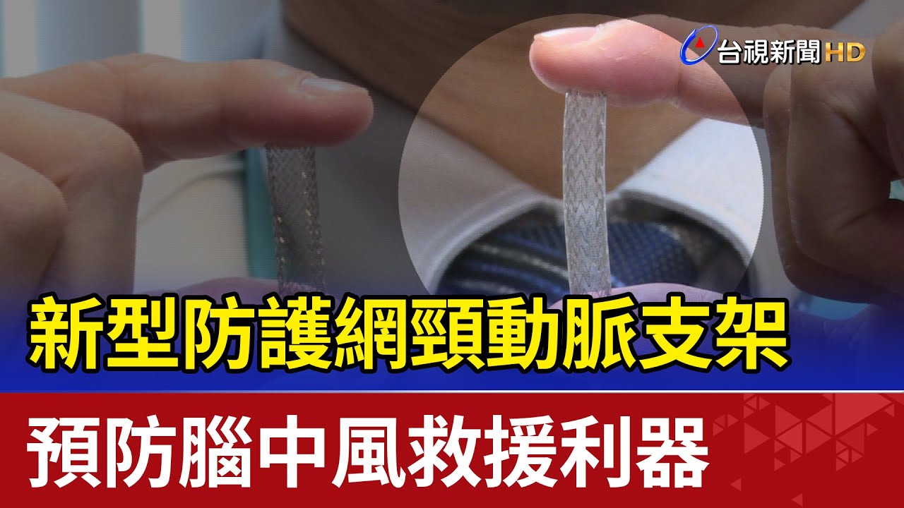 新型防護網頸動脈支架 預防腦中風救援利器
