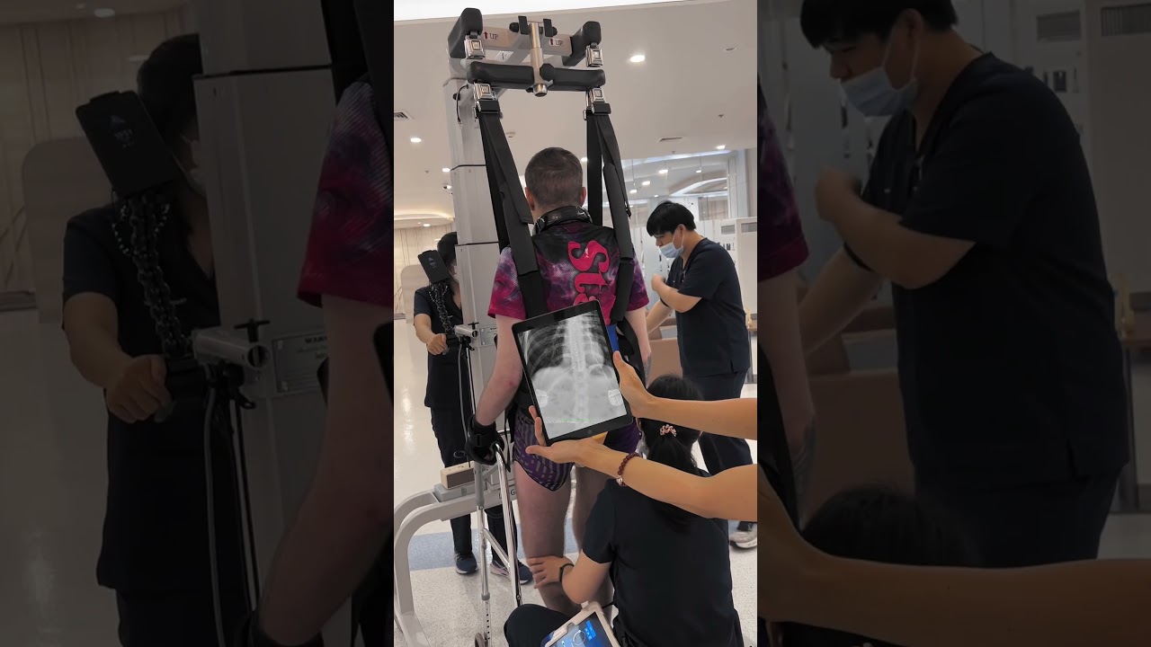 What epidural stimulator looks like in #spinalcordinjury patients?