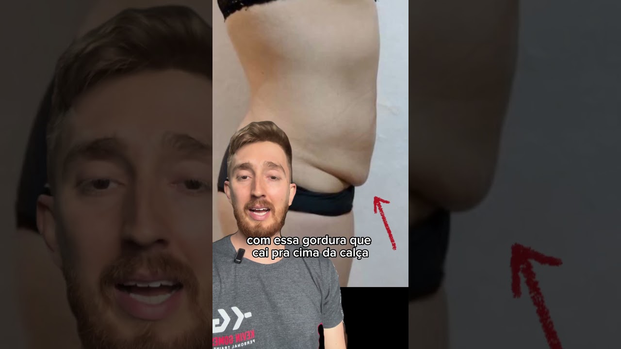 Como eliminar a flacidez do abd&ocirc;men!