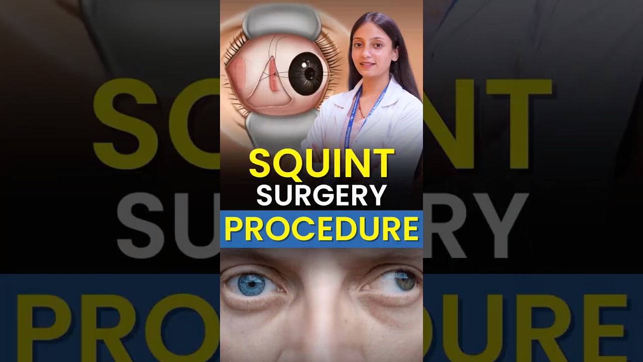 Squint Surgery Procedure Explained Simply! | Easy & Safe Treatment for Crossed Eyes