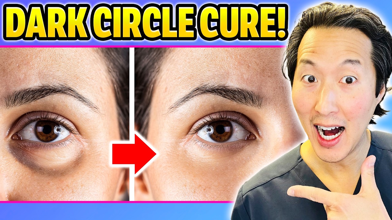 Plastic Surgeon: How to Get Rid of Dark Circles of Undereyes!