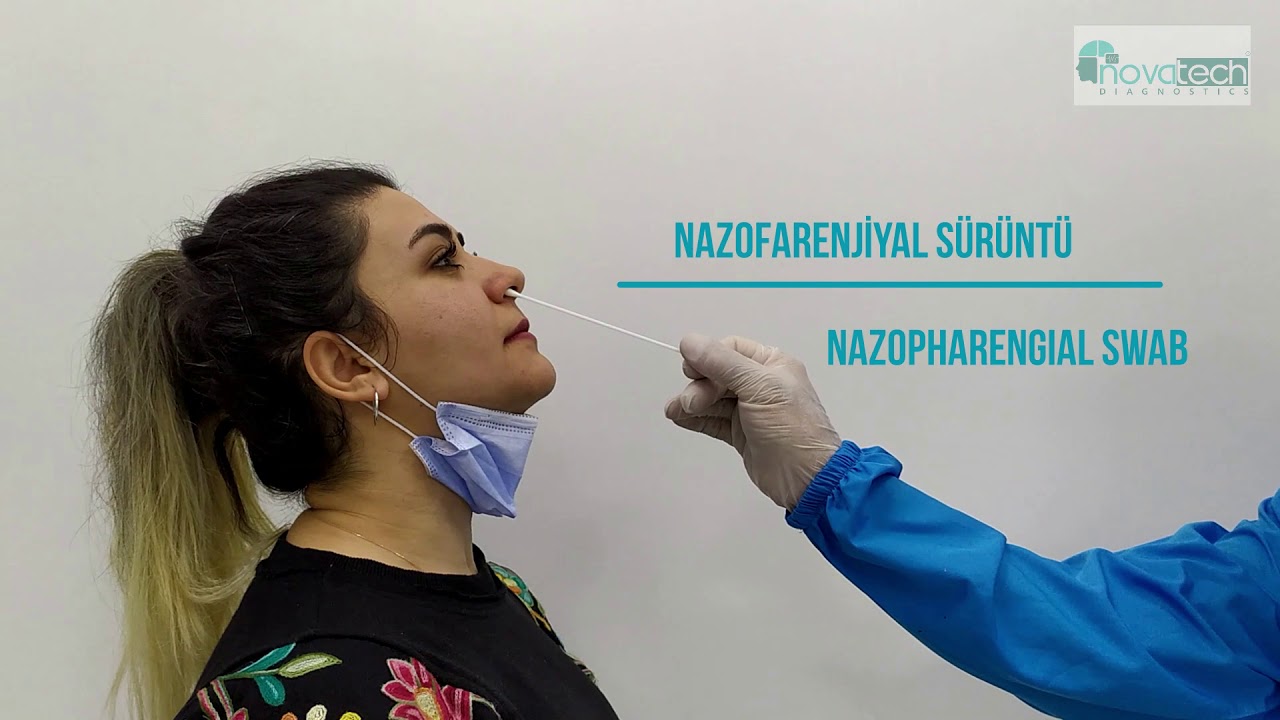 Novacheck Hızlı Antijen Test Kiti Kullanımı/Use of Novacheck Rapid Antigen Test Kit