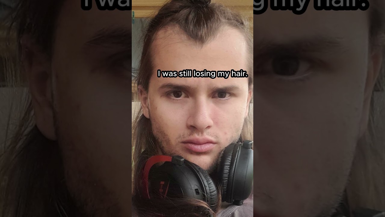 RADICAL GLOW-UP TRANSFORMATION POST-PUBERTY    