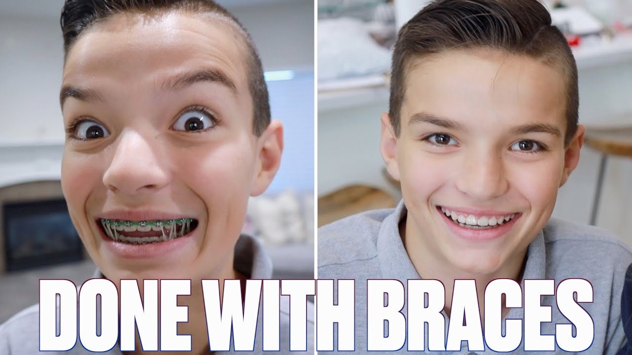 GETTING HIS BRACES OFF FOREVER | GETTING BRACES TAKEN OFF AFTER FOUR YEARS AND TWO ROUNDS OF BRACES