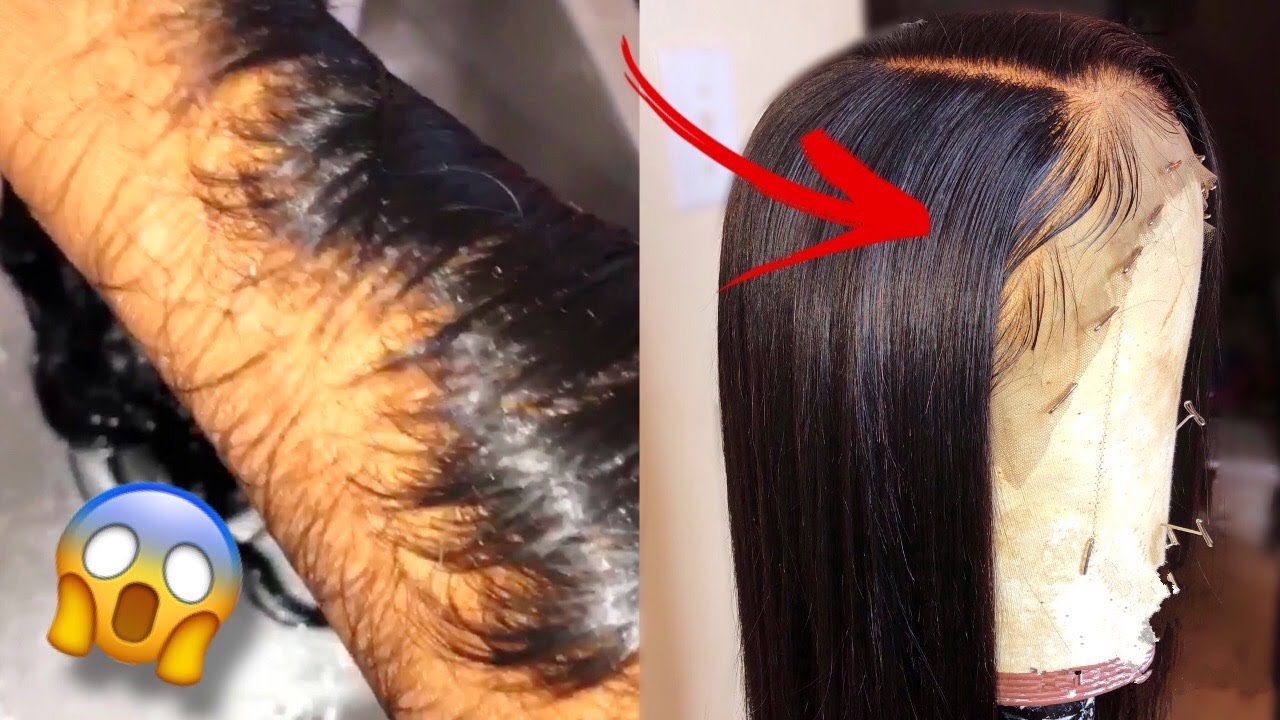 DIY: How To Bleach Knots Perfectly Natural Look |Beginner Friendly | Step By Step