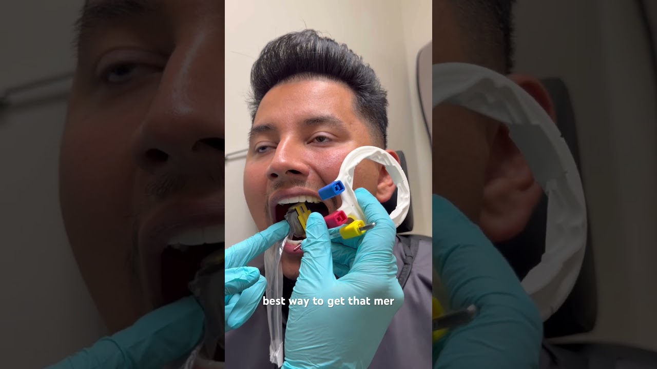 How to take the molar periapical radiograph #dentalhygienestudent  #dentist #dentalhygiene #xray