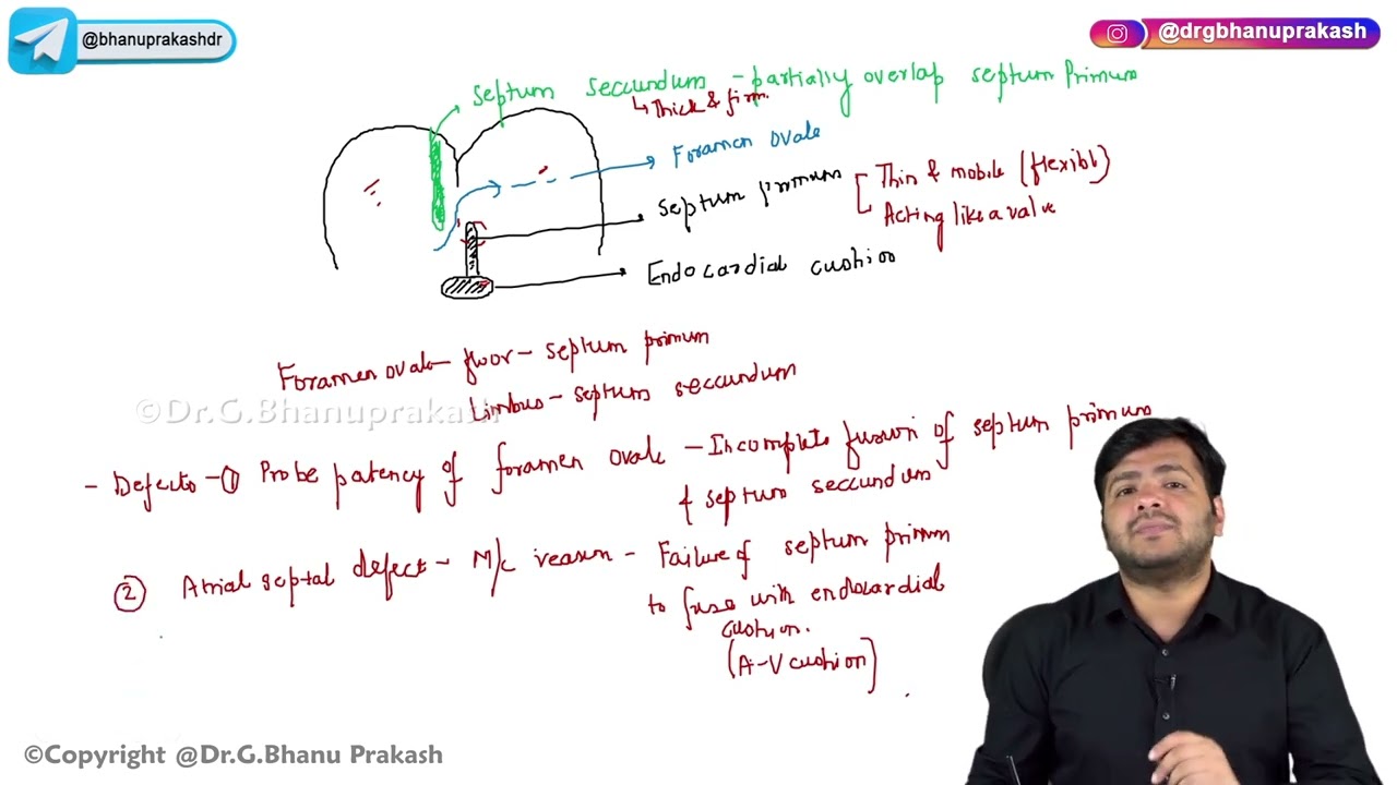 19. Septal Development in Cardiovascular System (CVS) Embryology