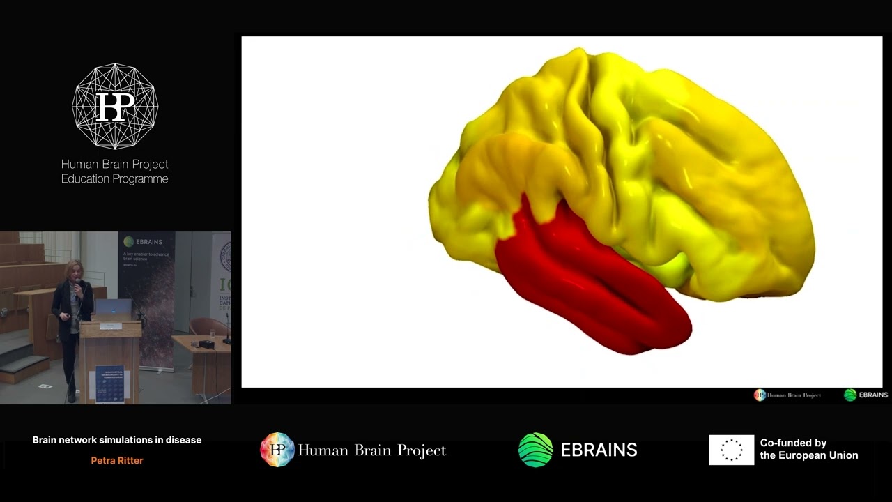 Petra Ritter - Brain network simulations in disease