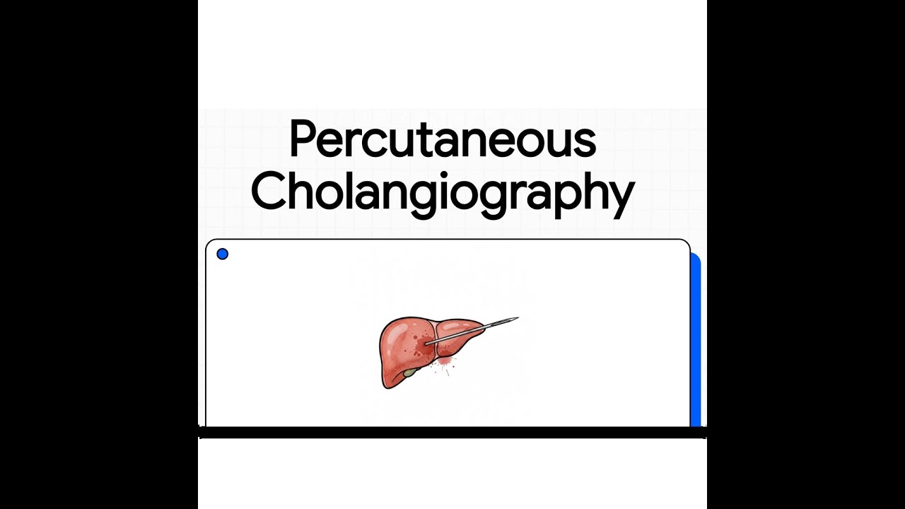 Percutaneous Cholangiography | Technique, Indications & Clinical Interpretation