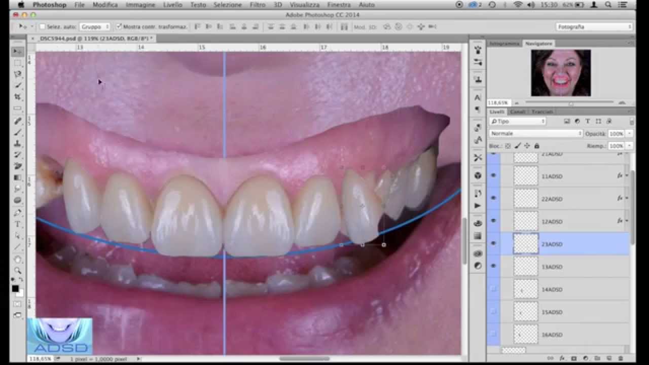 ADSD Aesthetic Digital Smile Design - Dal ritratto del paziente al Digital Dental Image Editing