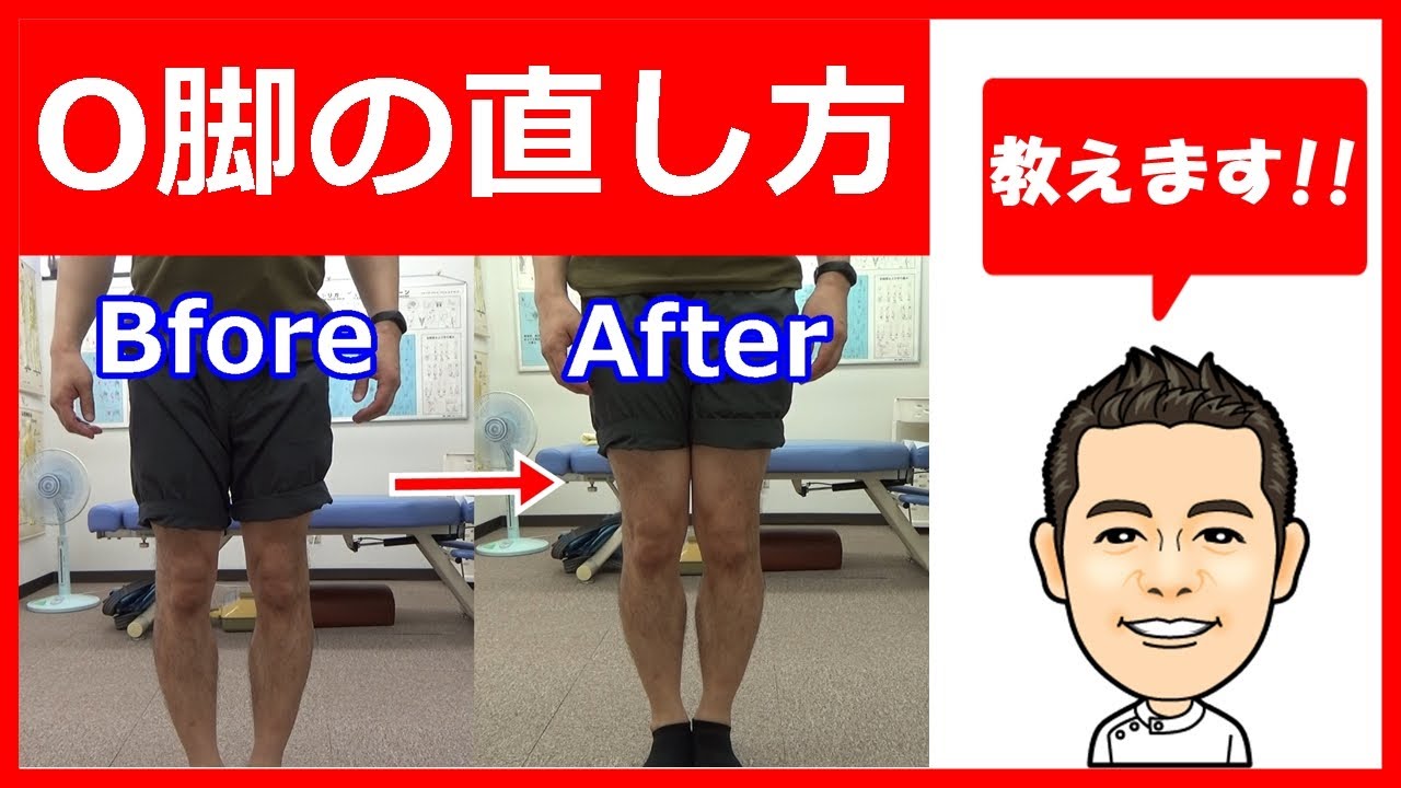 【O脚】お教えします！O脚の直し方【新田カイロ整体（東京　府中市）】