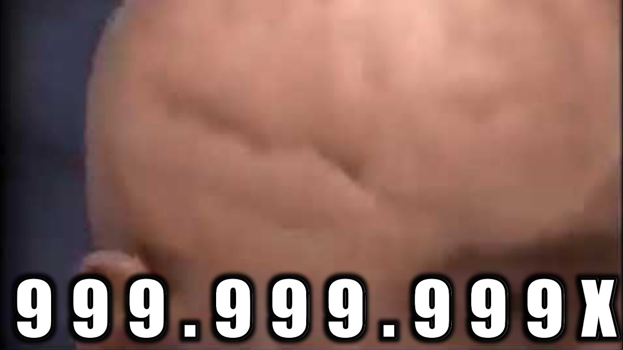 Brain Aneurysm Fart Meme Speed 999x