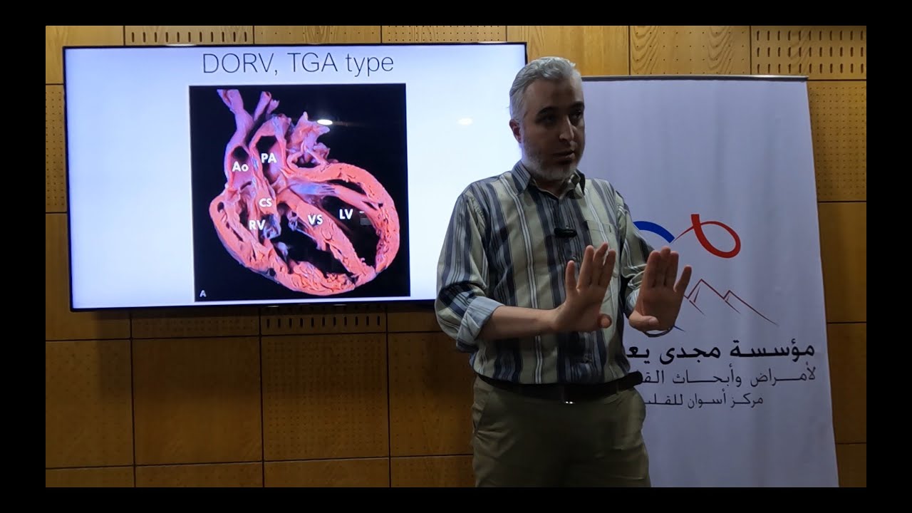 Double Outlet Right Ventricle - Hatem Hosny