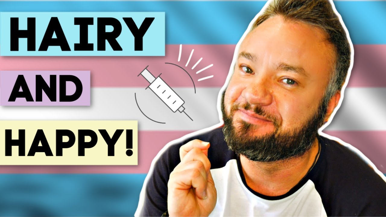7 Years On Testosterone | Physical & Emotional Changes