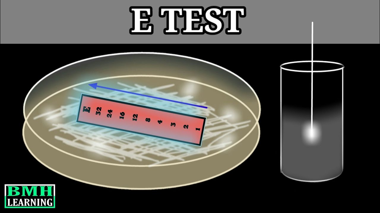E Test |  E Test For Antibiotic Susceptibility | MIC Determination By E Test | Epsilometer Test |
