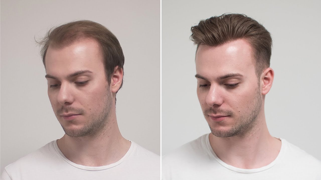 Drop Fade Sweep Back Hairstyle mit Haarsystem | Hair Transformation | Hairsystems Heydecke