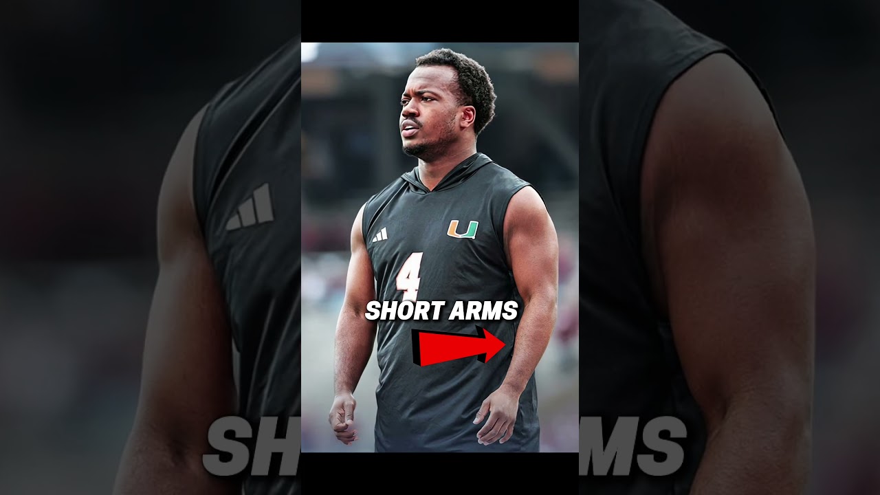 His Shorts Arms Are Drawing Concern 😬😭