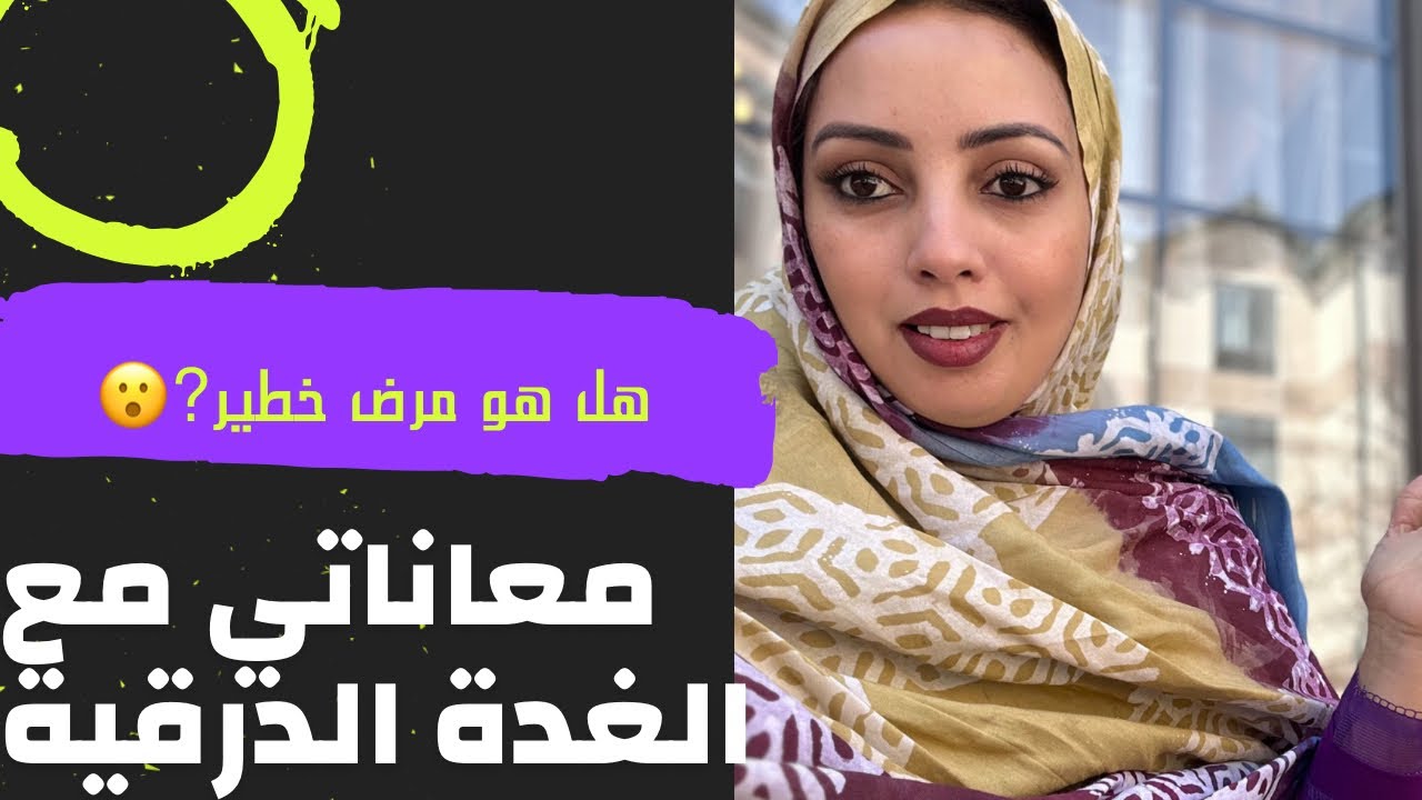 تجربتي مع مرض الغدة الدرقية| نشاط الغدة الدرقية وجحوض العينين | التحاليل  Tsh/T4/T3