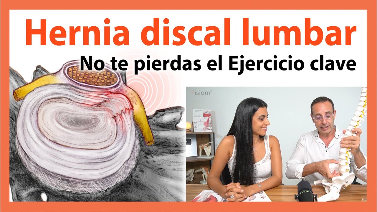 🔴 DOLOR Lumbar por Hernia discal 👉 EJERCICIO Clave | Cómo evitar las discopatías degenerativas