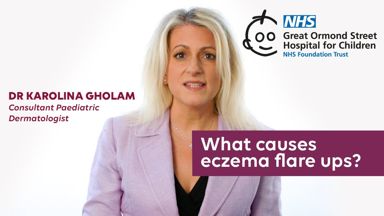 What causes eczema flare ups?