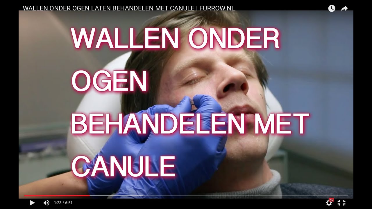 WALLEN ONDER OGEN LATEN BEHANDELEN MET CANULE | FURROW.NL