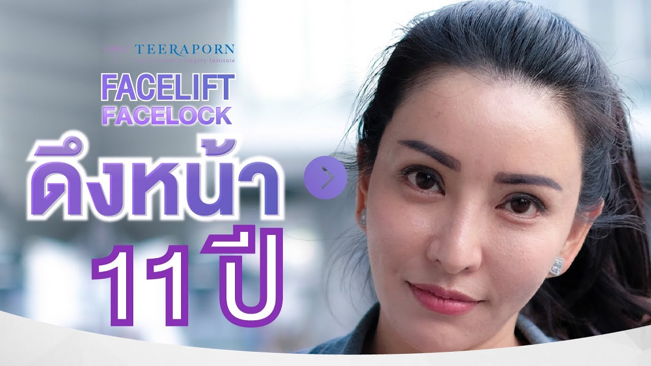 รีวิวดึงหน้า Facelift 