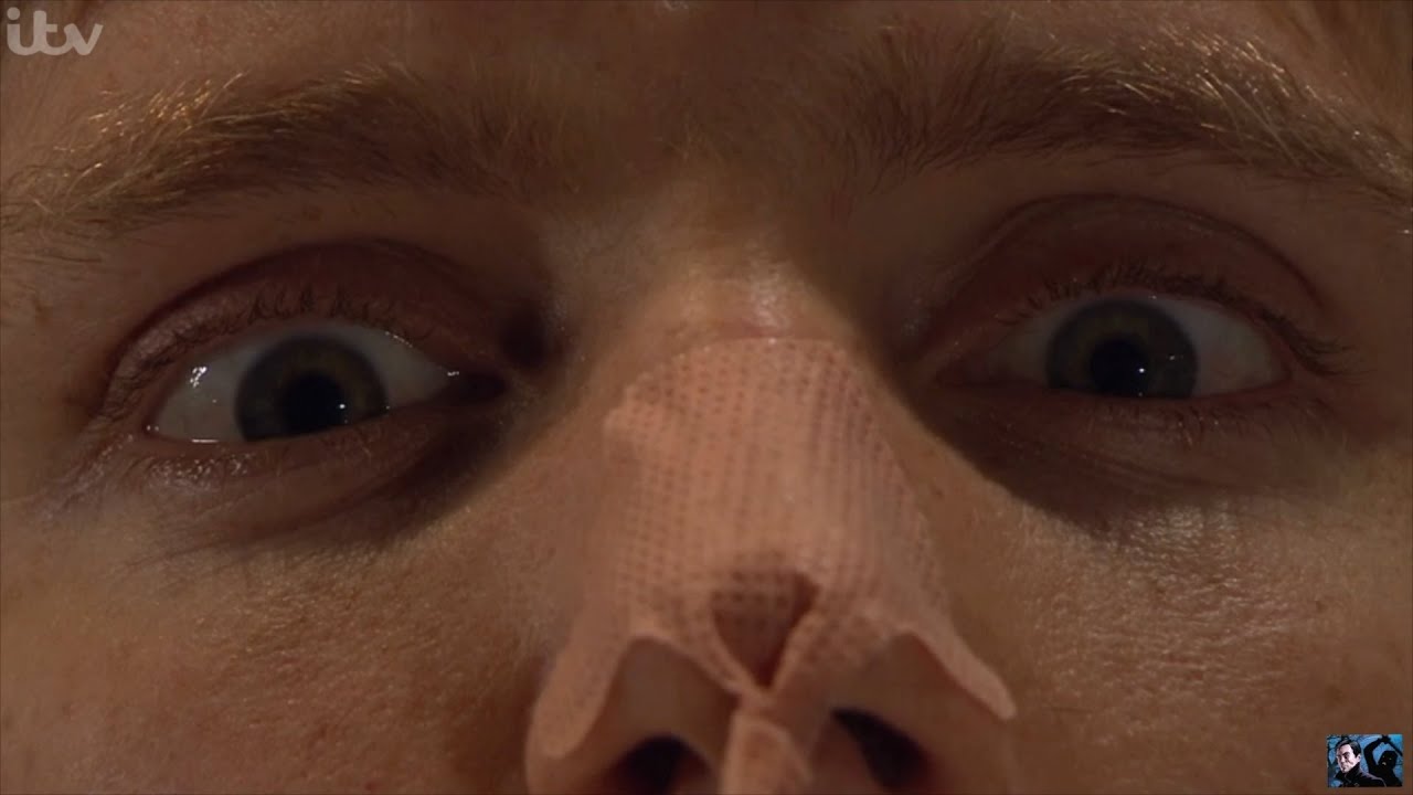 Emmerdale - Robert Wakes Up